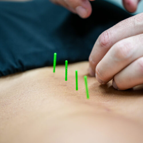 Acu portrait (photoshoot) Mike low back-physiotherapy in Burlington, sports rehab near me, electro-acupuncture Burlington Acu portrait (photoshoot) Mike low back-physiotherapy in Burlington, sports rehab near me, electro-acupuncture Burlington